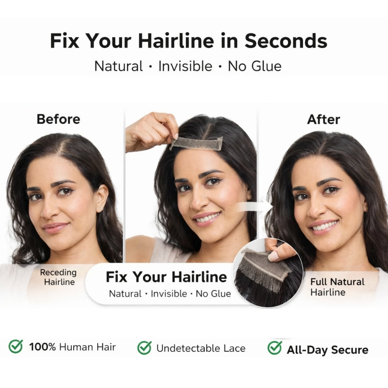 Instantly Fix Your Hairline — No One Will Ever Know