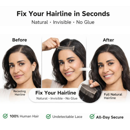Instantly Fix Your Hairline — No One Will Ever Know